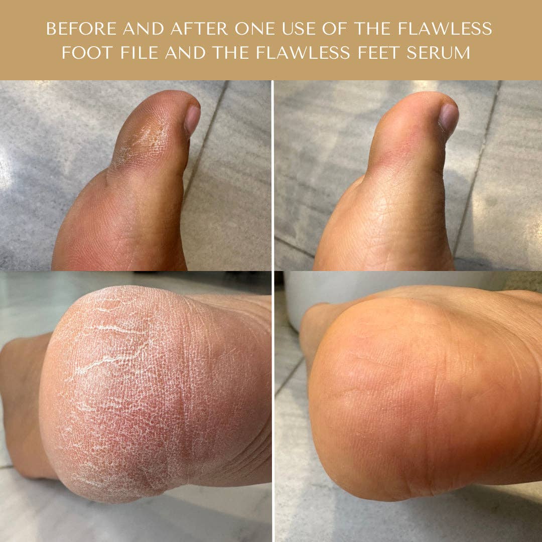 Flawless Feet Serum - Image 3