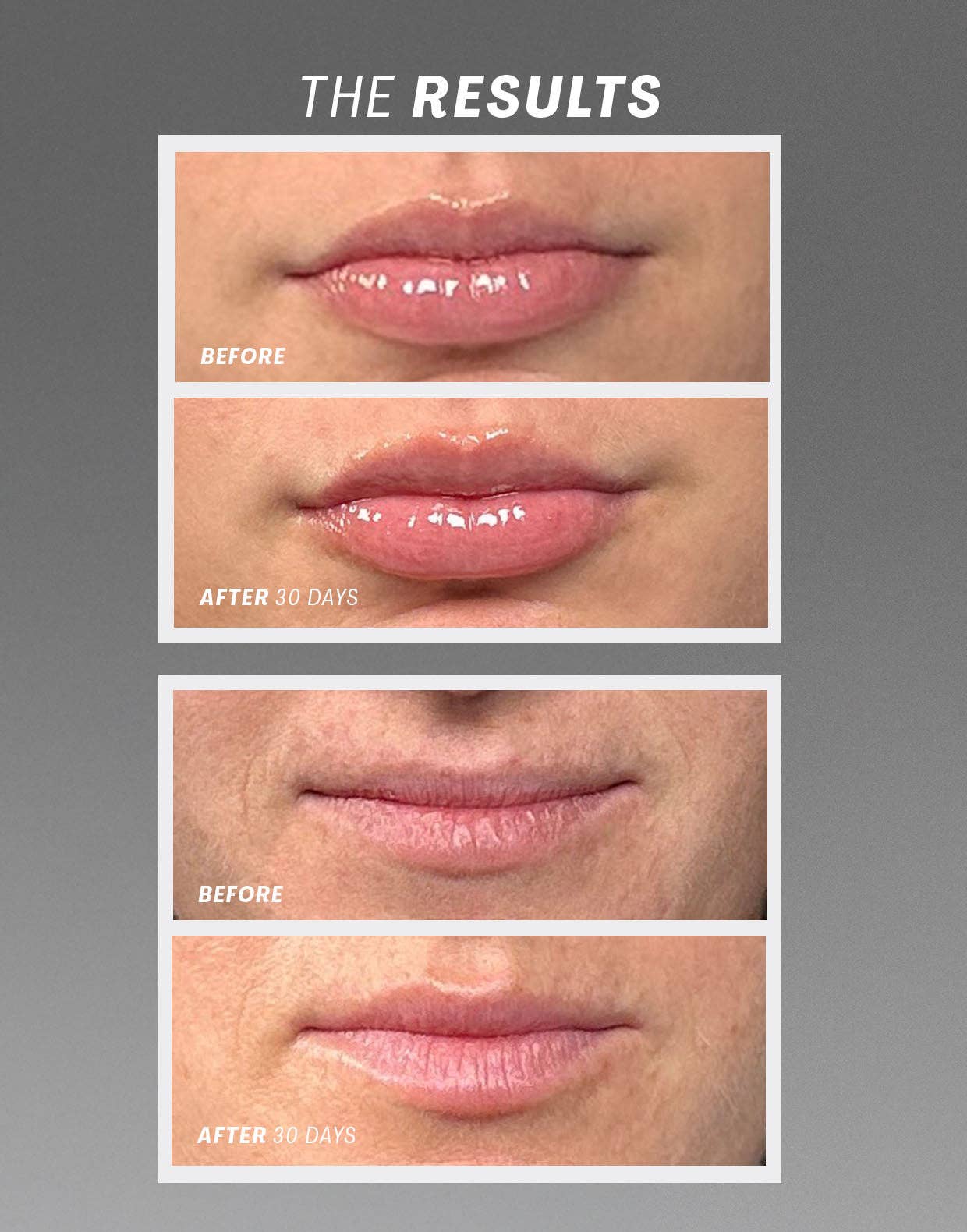 Lip Oasisᵀᴹ Glossy Treatment - Image 3
