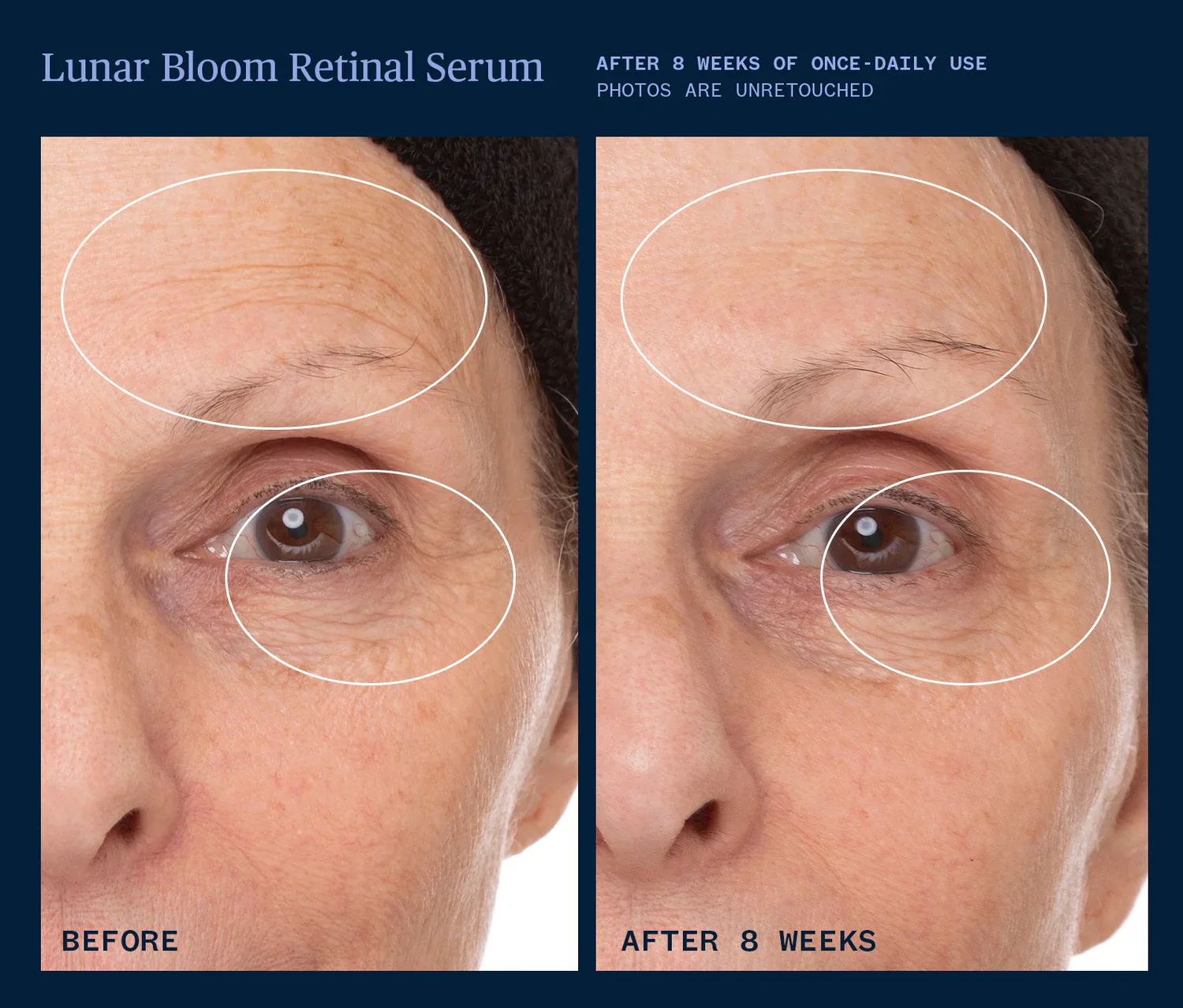 Lunar Bloom Retinal Serum - Image 2