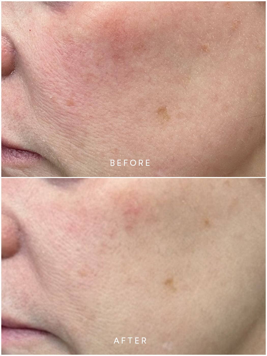 Renew Microbiome Enzyme Essence - Image 3