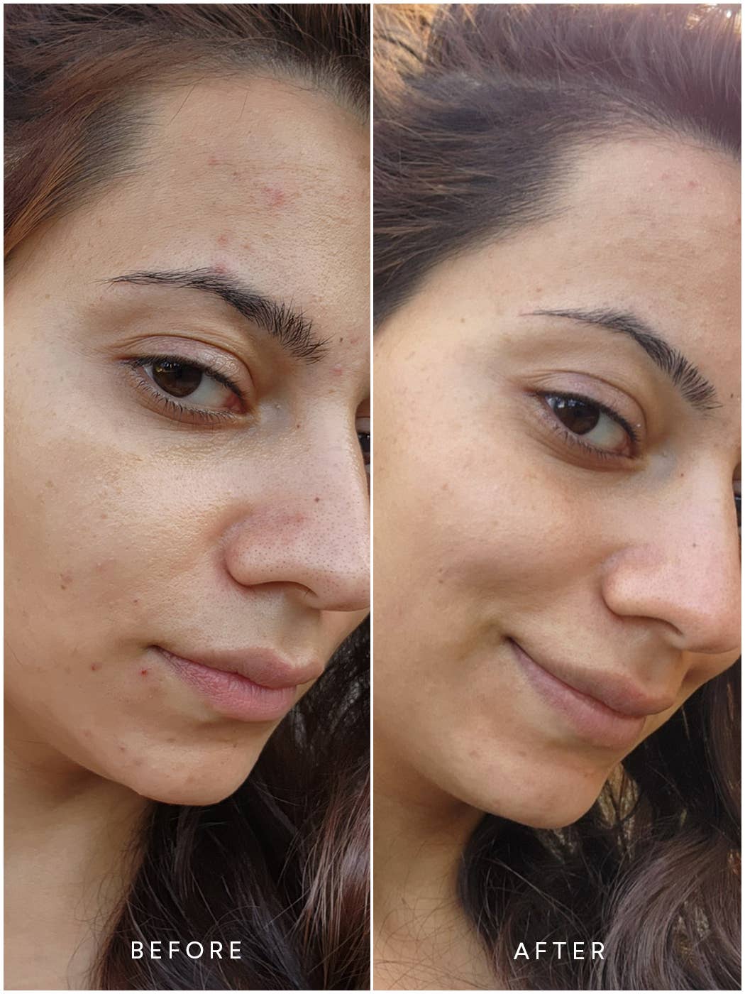 Renew Pure Radiance Oil - Image 5