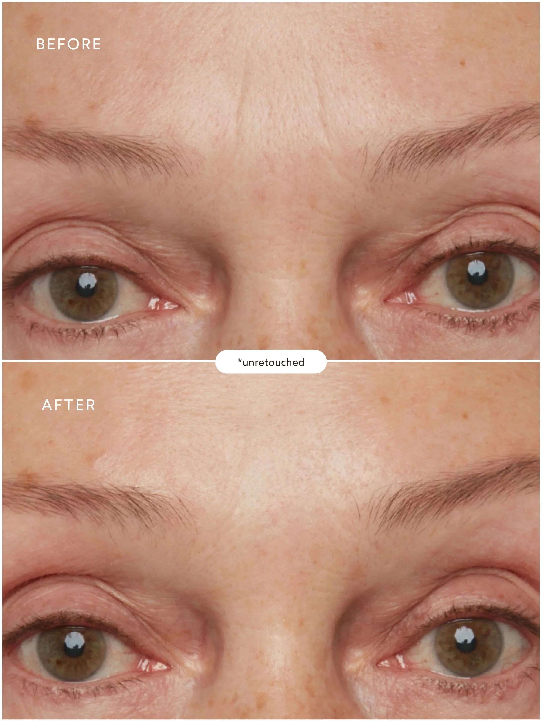 Renew Pure Radiance Oil - Image 6