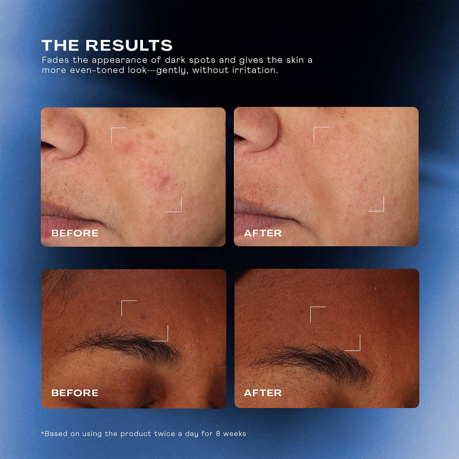 Total Clarity Dark Spot Serum - Image 3